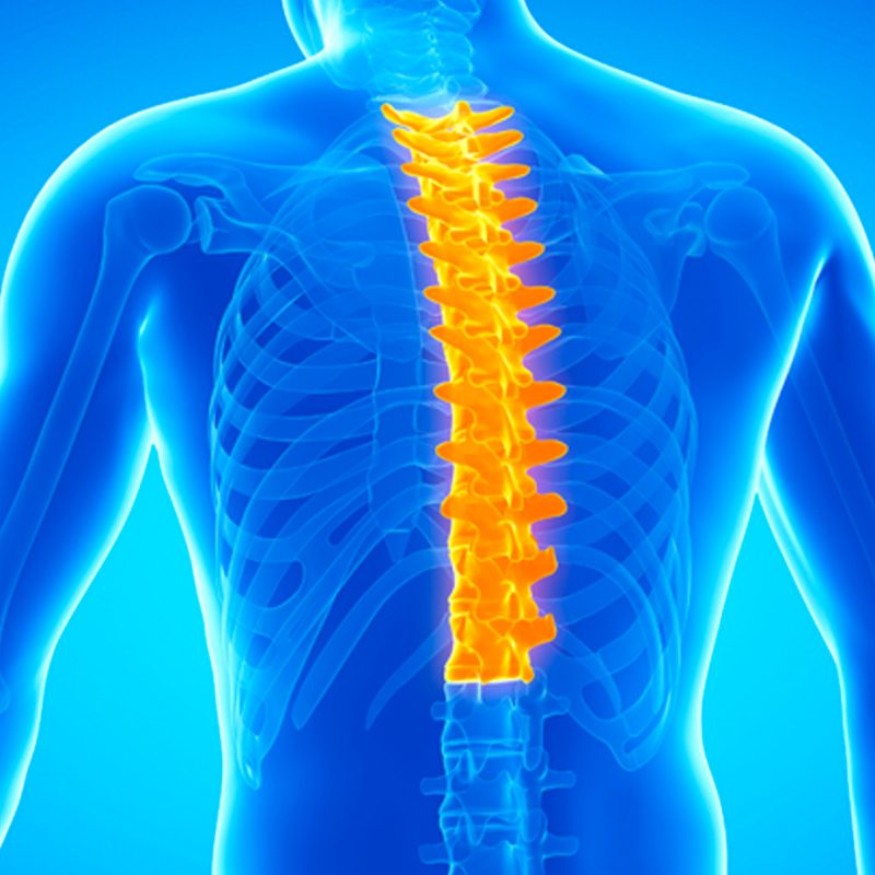 Spondyloarthritis